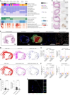 SARS-CoV-2 infection triggers pro-atherogenic inflammatory responses in human coronary vessels