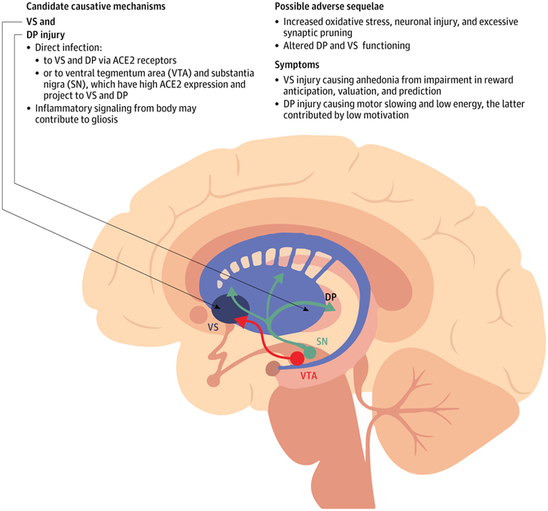 Neuroinflammation After COVID-19 With Persistent Depressive and Cognitive Symptoms