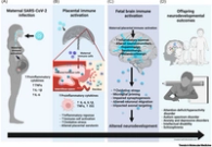 COVID-19 in pregnancy: implications for fetal brain development