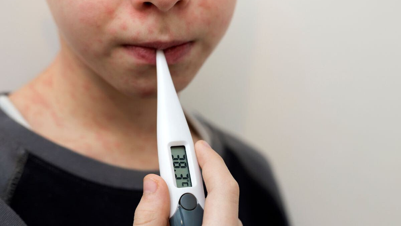 México ya es el país de América con más muertes por sarampión y entre todas las víctimas existe algo común: nunca fueron vacunados