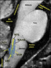 Long COVID or Post-acute Sequelae of COVID-19 (PASC): An Overview of Biological Factors That May Contribute to Persistent Symptoms