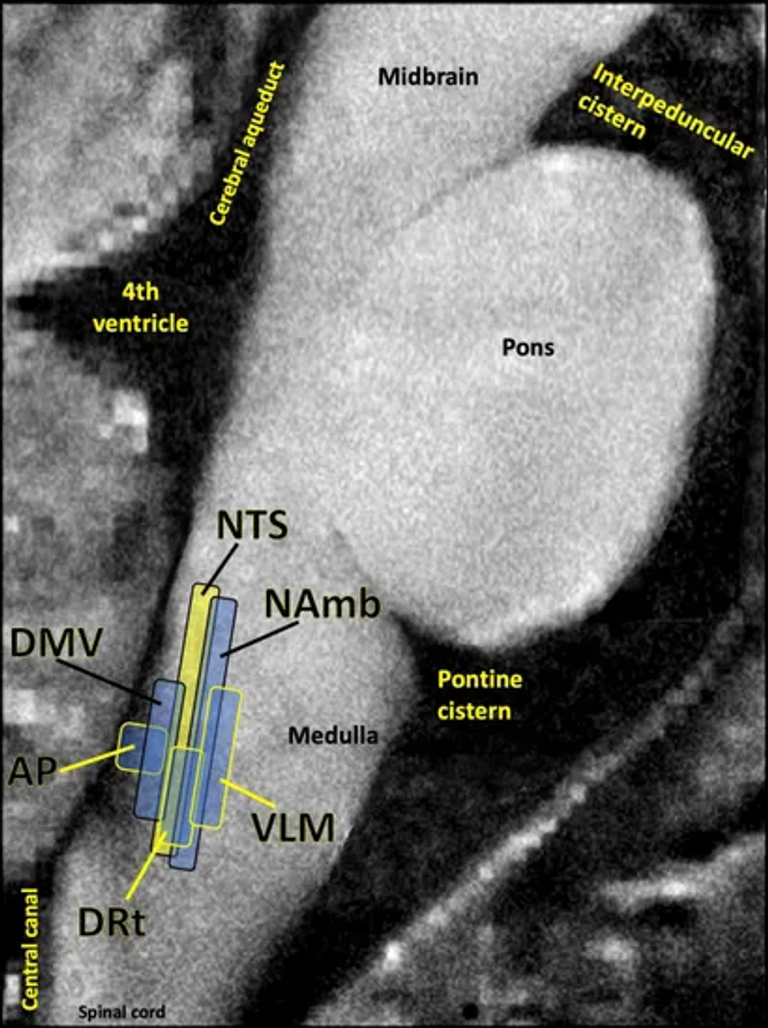 Long COVID or Post-acute Sequelae of COVID-19 (PASC): An Overview of Biological Factors That May Contribute to Persistent Symptoms