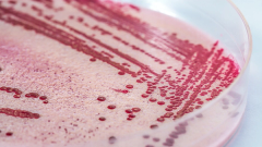 Deadly multistate Listeria outbreak tied to prepared pasta meals expands