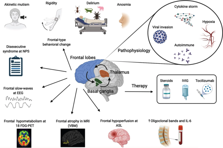 Is the Frontal Lobe the Primary Target of SARS-CoV-2?