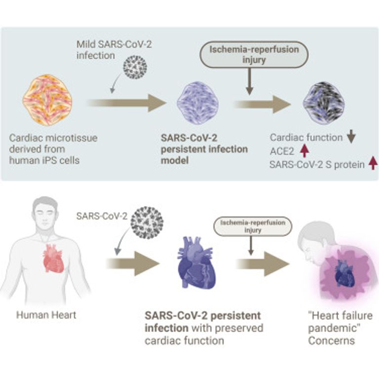 Predicted risk of heart failure pandemic due to persistent SARS-CoV-2 infection using a three-dimensional cardiac model