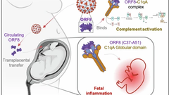 Transplacental SARS-CoV-2 protein ORF8 binds to complement C1q to trigger fetal inflammation