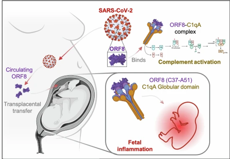 Transplacental SARS-CoV-2 protein ORF8 binds to complement C1q to trigger fetal inflammation
