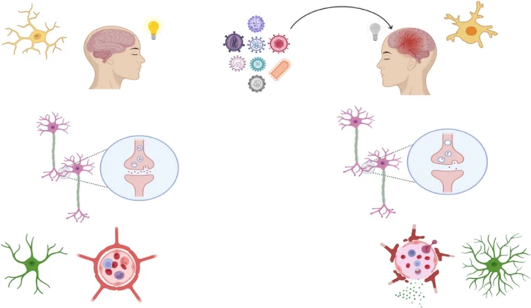 Chronic Neuroplasticity Changes Following Neurotropic Viral Infection: Mechanisms and Implications