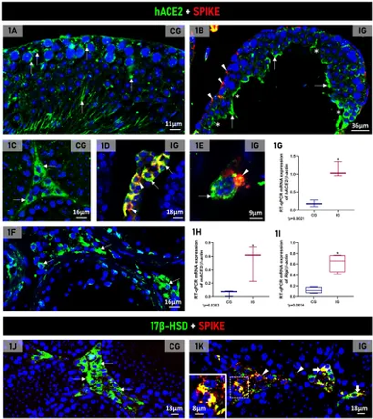 SARS-CoV-2 exploits steroidogenic machinery, triggers lipid metabolism for viral replication and induces immune response in Leydig cells of K18-hACE2 mice