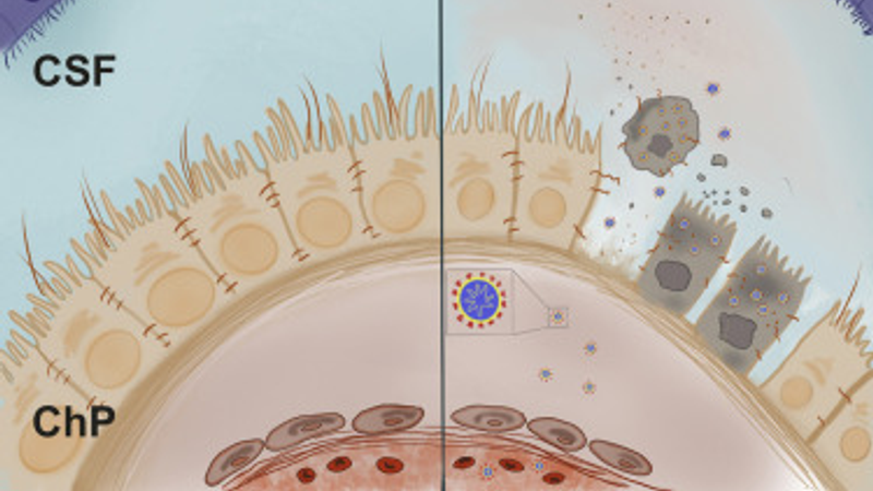 SARS-CoV-2 Infects the Brain Choroid Plexus and Disrupts the Blood-CSF Barrier in Human Brain Organoids