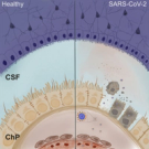 SARS-CoV-2 Infects the Brain Choroid Plexus and Disrupts the Blood-CSF Barrier in Human Brain Organoids