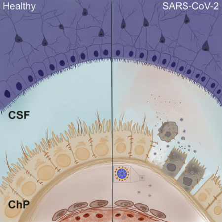 SARS-CoV-2 Infects the Brain Choroid Plexus and Disrupts the Blood-CSF Barrier in Human Brain Organoids