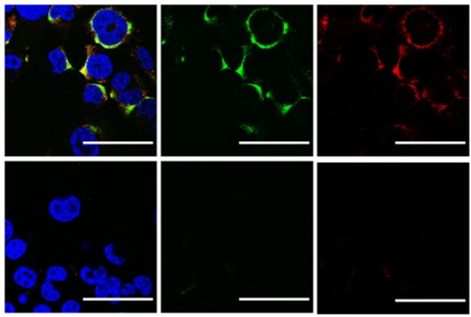 Cientistas usam ultrassom para estourar vírus da influenza A e da COVID-19 sem danificar células humanas