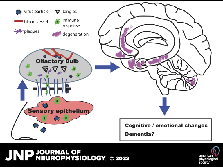 COVID-19 and olfactory dysfunction: a looming wave of dementia?