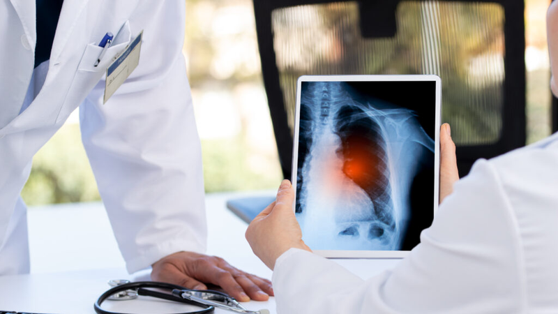 El COVID persistente deja una huella inmunitaria distinta que podría guiar futuros tratamientos