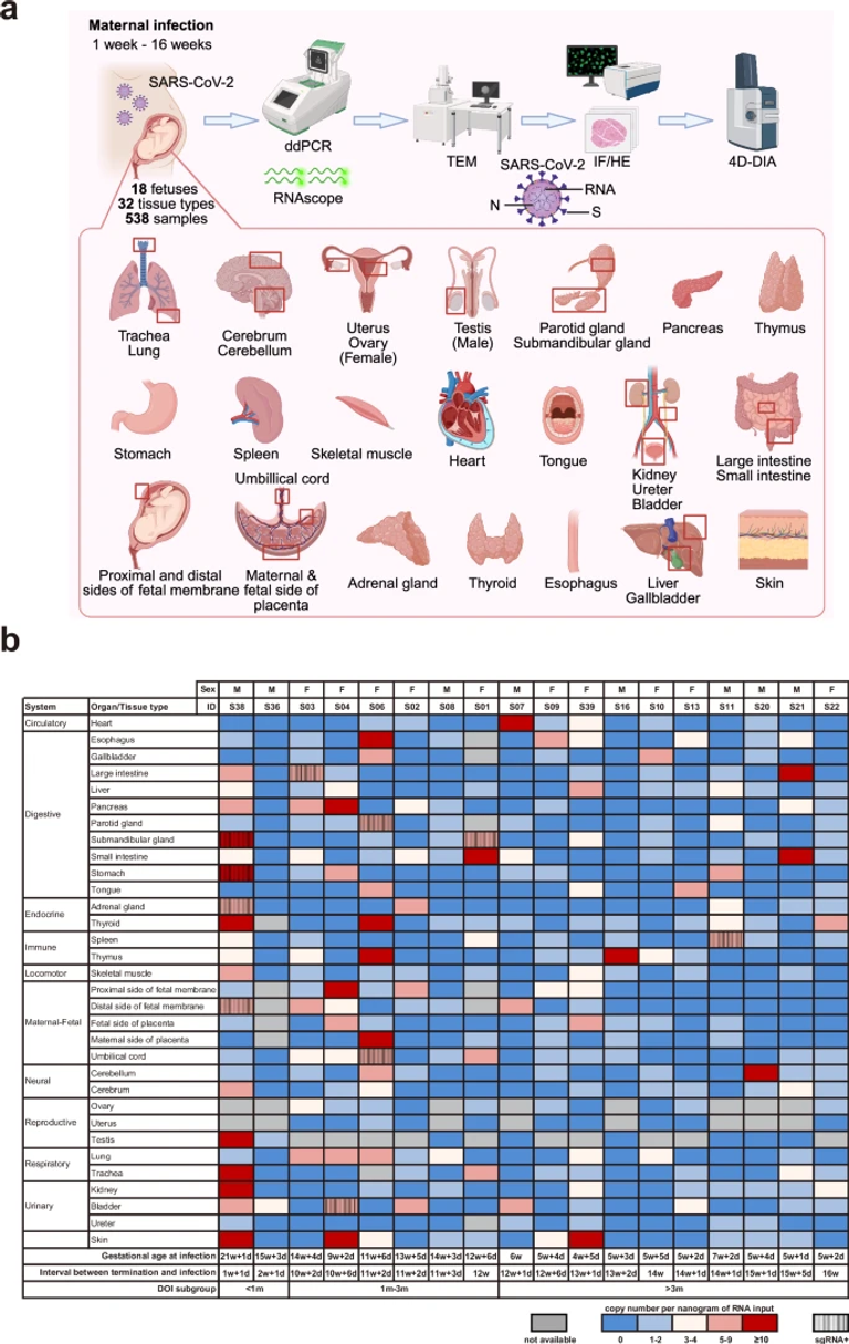Presence of SARS-CoV-2 in fetal organs via intraamniotic infection