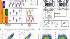 Accelerated brain ageing during the COVID-19 pandemic