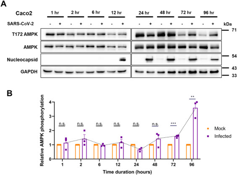 Metformin suppresses SARS-CoV-2 in cell culture