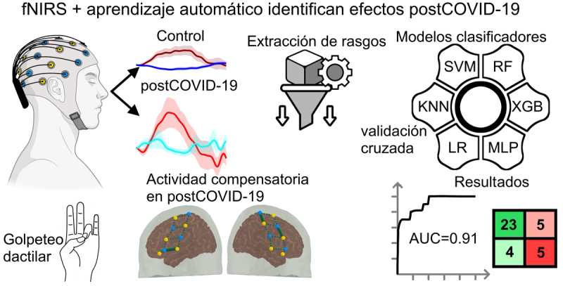 Las huellas cerebrales del postCOVID-19