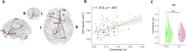 Choroid plexus volume is enlarged in long COVID and associated with cognitive and brain changes