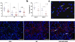 ACE2-independent infection of T lymphocytes by SARS-CoV-2