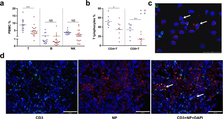 ACE2-independent infection of T lymphocytes by SARS-CoV-2