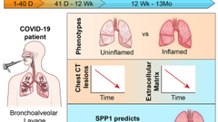 Longitudinal analysis of the lung proteome reveals persistent repair months after mild to moderate COVID-19