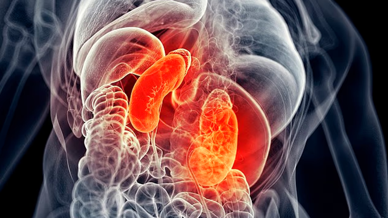 Catching Covid significantly raises the risk of developing kidney disease, researchers find