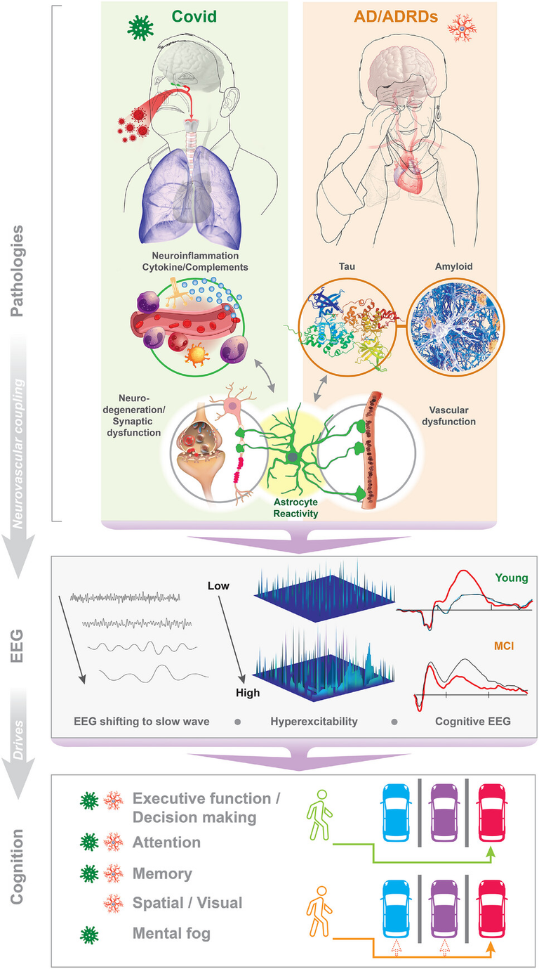 Parallel electrophysiological abnormalities due to COVID-19 infection and to Alzheimer's disease and related dementia