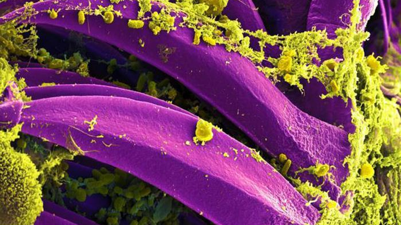 Suspected plague incident leaves 1 dead, 200 under quarantine in Siberia