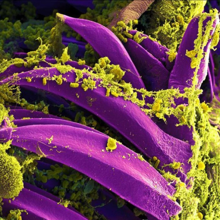 Suspected plague incident leaves 1 dead, 200 under quarantine in Siberia