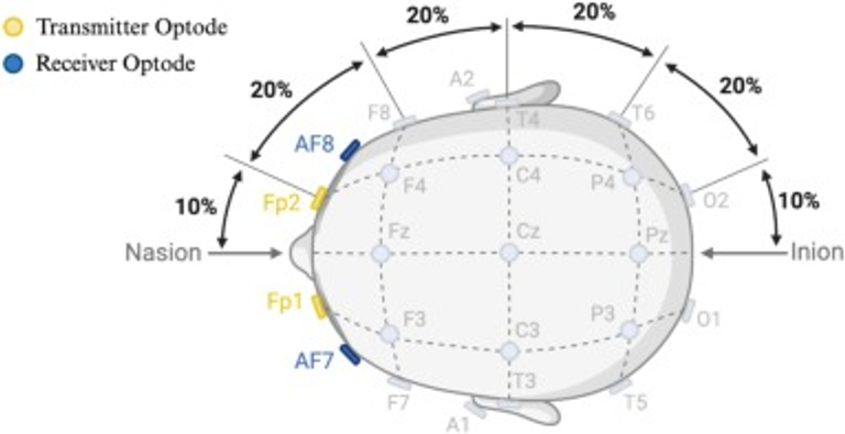 COVID-19 may Enduringly Impact Cognitive Performance and Brain Haemodynamics in Undergraduate Students