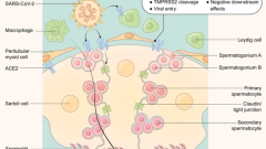 Systematic analyses of the factors influencing sperm quality in patients with SARS-CoV-2 infection