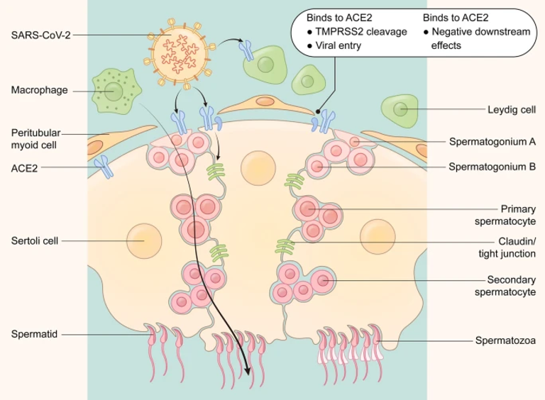 Systematic analyses of the factors influencing sperm quality in patients with SARS-CoV-2 infection