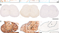 Pathogenic IgG from long COVID patients with neurological sequelae triggers sensitive but not cognitive impairments upon transfer into mice