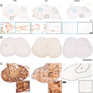Pathogenic IgG from long COVID patients with neurological sequelae triggers sensitive but not cognitive impairments upon transfer into mice