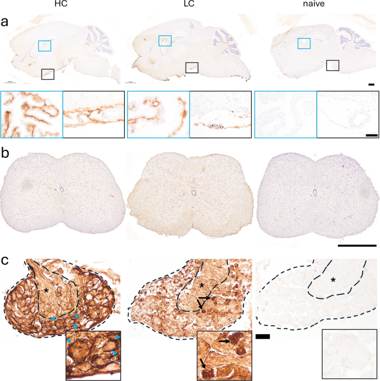 Pathogenic IgG from long COVID patients with neurological sequelae triggers sensitive but not cognitive impairments upon transfer into mice