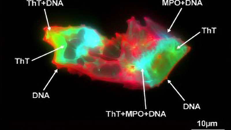 Scientists Uncover Hidden Blood Pattern in Long COVID
