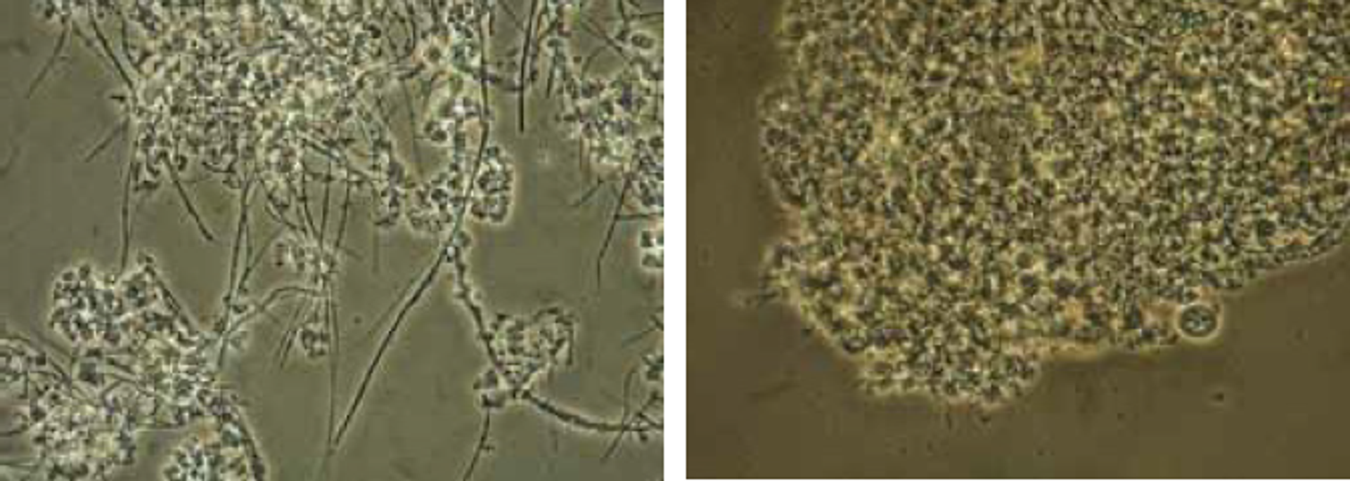 Microscopic analyses showed a reduction of filaments and an increase in floc density