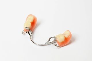 Partial Dentures