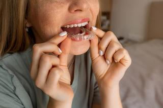 Adult Orthodontics with Invisalign