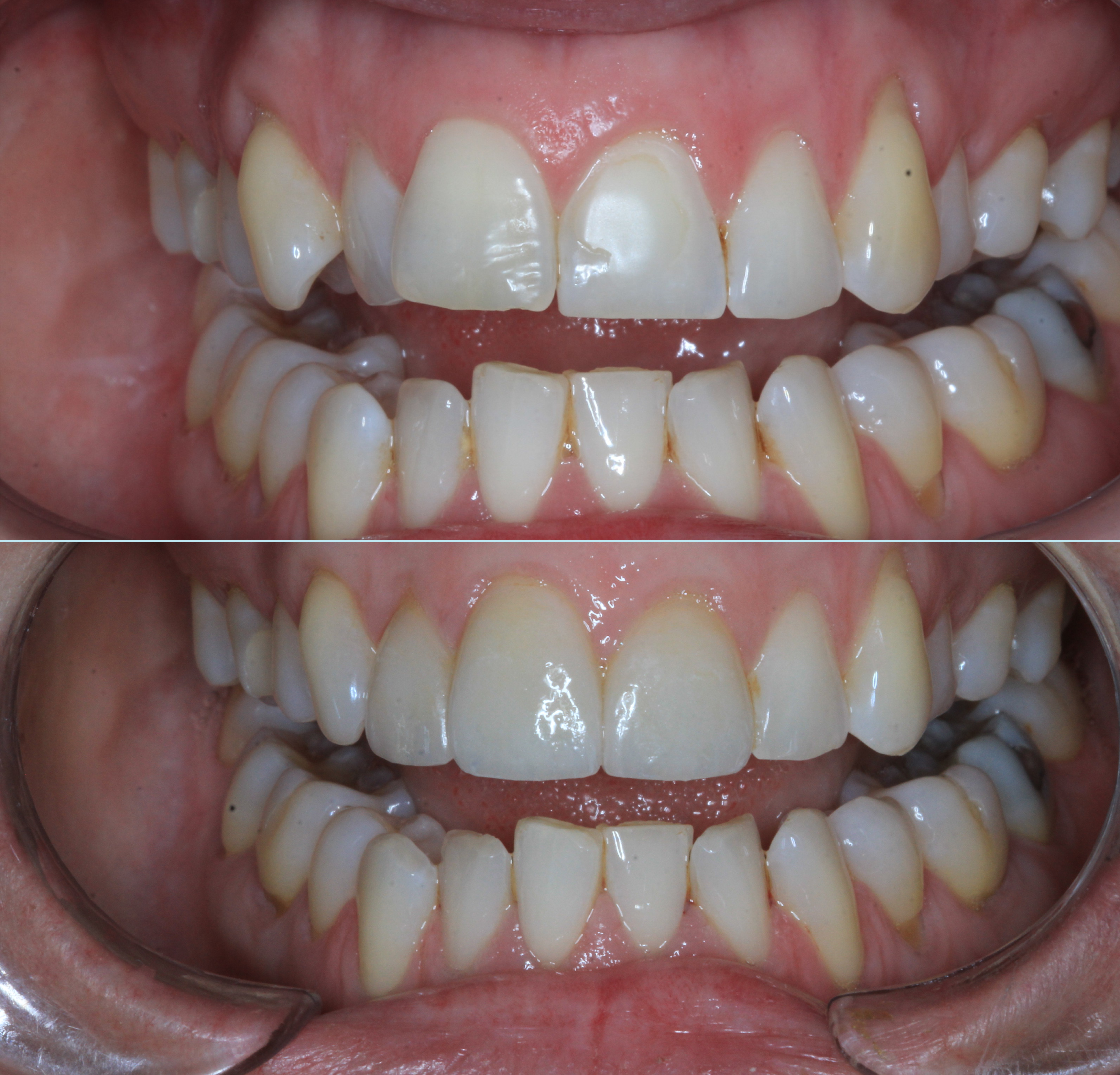 See real treatment results