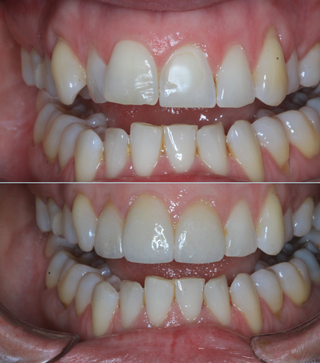 See real treatment results
