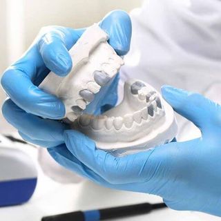 Image of dental crowns on a plaster mold of a jaw.