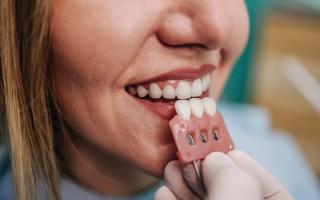 Image of a female patient at a dental clinic, choose which shade of tooth.