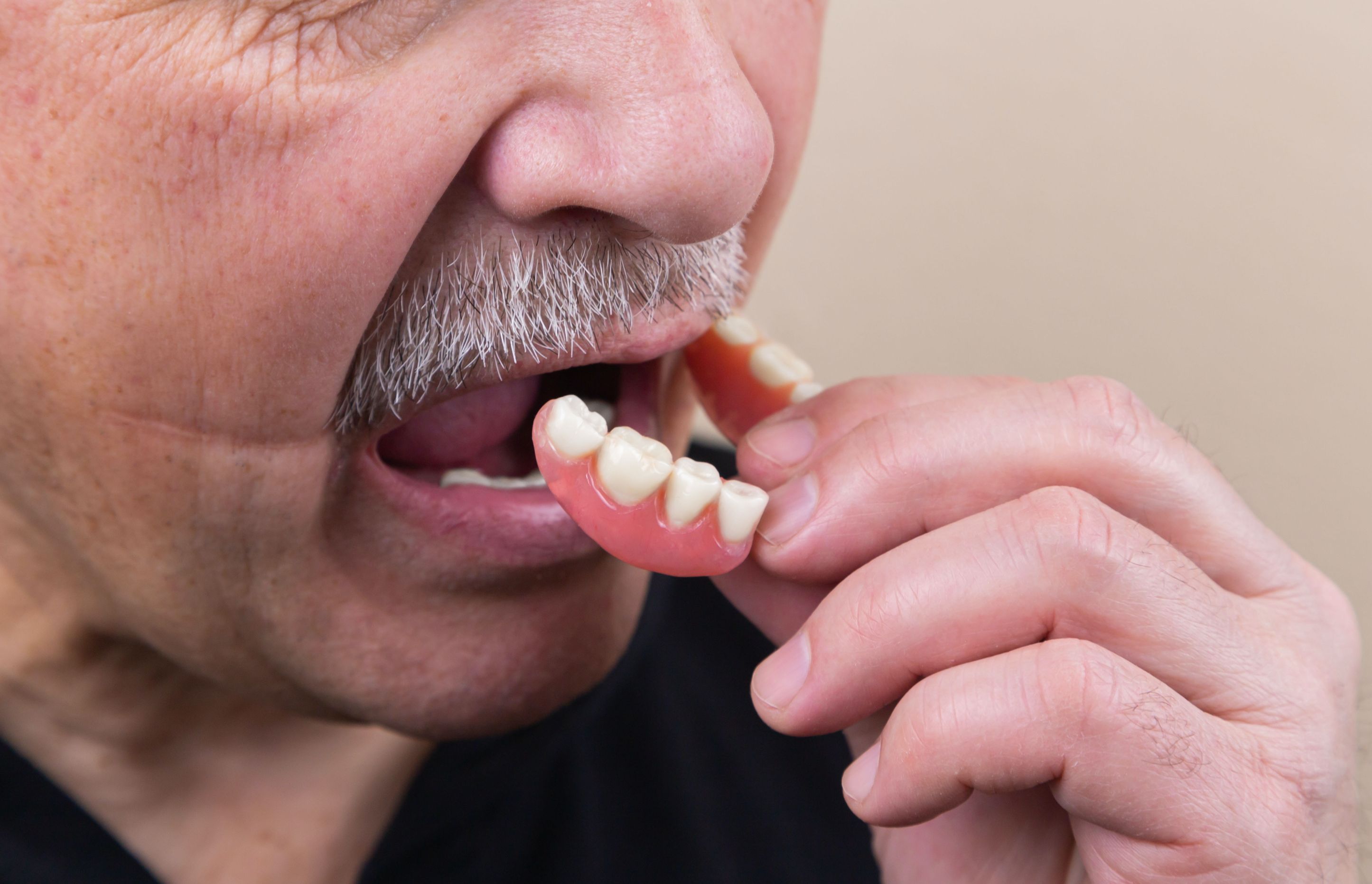 Immediate Dentures