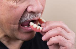Immediate Dentures