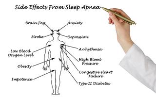 Side effects from sleep apnea dental loving care