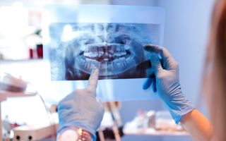 Dental technology - Digital dental x-rays