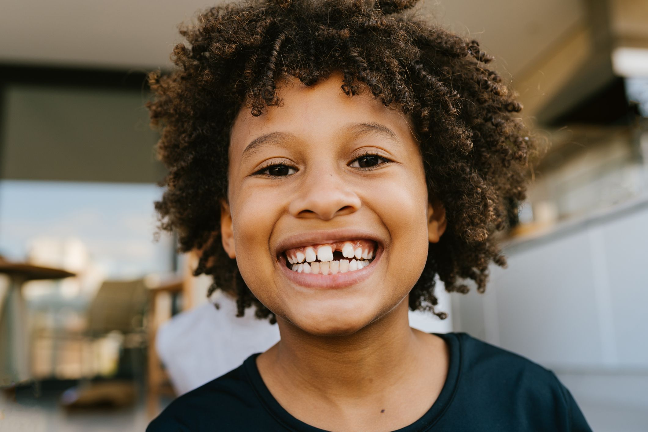 Missing Teeth
